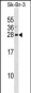 ARL1 Antibody (Center)